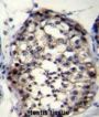 Ropporin-1-Like Protein (ROPN1L) Antibody
