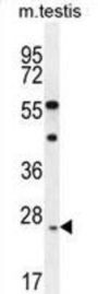 Ropporin-1-Like Protein (ROPN1L) Antibody