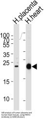 Frequently Rearranged In Advanced T-Cell Lymphomas 2 (FRAT2) Antibody