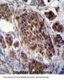 Frequently Rearranged In Advanced T-Cell Lymphomas 2 (FRAT2) Antibody