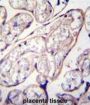 Pyrroline-5-Carboxylate Reductase Family Member 2 (PYCR2) Antibody