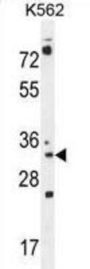 Pyrroline-5-Carboxylate Reductase Family Member 2 (PYCR2) Antibody