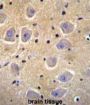 Protein Shisa-6 (SHISA6) Antibody