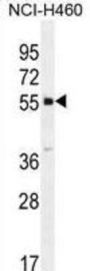 Protein Shisa-6 (SHISA6) Antibody