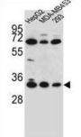 Olfactory Receptor 2T3 (OR2T3) Antibody