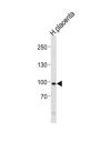 X-Ray Repair Cross Complementing 5 (XRCC5) Antibody