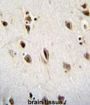 RNA-Binding Protein Musashi Homolog 1 (MSI1) Antibody