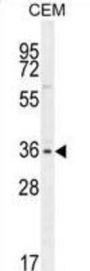 RNA-Binding Protein Musashi Homolog 1 (MSI1) Antibody