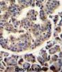Tripartite Motif-Containing Protein 72 (TRIM72) Antibody