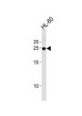 Homeobox Protein Hox-A6 (HOXA6) Antibody