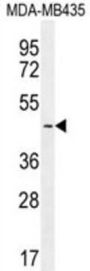 Lymphoid Enhancer Binding Factor 1 (LEF1) Antibody