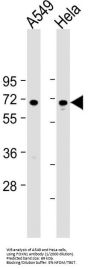 Forkhead Box Protein N1 (FOXN1) Antibody
