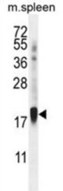 Zinc Finger Protein 593 (ZNF593) Antibody
