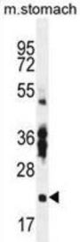 RNA-Binding Protein With Multiple Splicing 2 (RBPMS2) Antibody