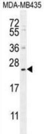 Sesquipedalian-1 (FAM109A) Antibody