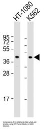 Choline-Phosphate Cytidylyltransferase A (PCYT1A) Antibody