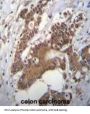 Choline-Phosphate Cytidylyltransferase A (PCYT1A) Antibody