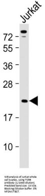T-Cell Receptor Beta Chain V Region CTL-L17 / TCRB (TRBV7-9) Antibody