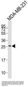 T-Cell Receptor Beta Chain V Region CTL-L17 / TCRB (TRBV7-9) Antibody