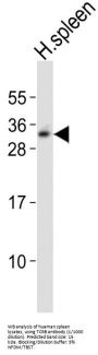 T-Cell Receptor Beta Chain V Region CTL-L17 / TCRB (TRBV7-9) Antibody