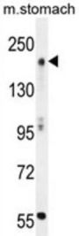MOZ/MYST3 Antibody