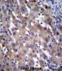 X-Linked Retinitis Pigmentosa GTPase Regulator (RPGR) Antibody