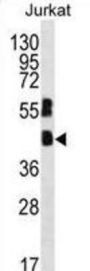 Transcription Factor MafB (MAFB) Antibody