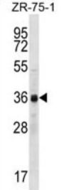 Cyclin-Y-Like Protein 2 (CCNYL2) Antibody