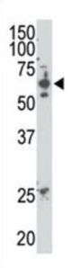 SUMO Specific Peptidase 2 (SENP2) Antibody
