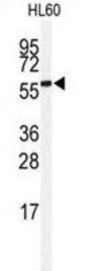 SUMO Specific Peptidase 2 (SENP2) Antibody