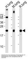 Pulmonary Surfactant-Associated Protein C (SFTPC) Antibody