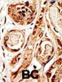SUMO1/Sentrin/SMT3 Specific Peptidase 3 (SENP3) Antibody