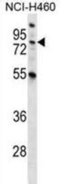 MST1 Antibody