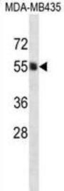 Phosphatidylinositol Glycan Anchor Biosynthesis Class A (PIGA) Antibody