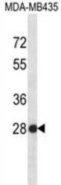 Small Nuclear Ribonucleoprotein Polypeptide B2 (SNRPB2) Antibody