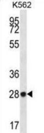 Zinc Finger Protein 146 (ZNF146) Antibody