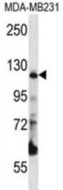 PITRM1 Antibody