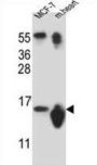 Small Nuclear Ribonucleoprotein D3 Polypeptide (SNRPD3) Antibody