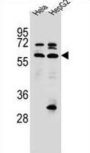 Selenoprotein N (SEPN1) Antibody