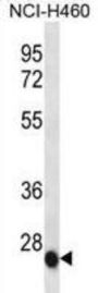 Interleukin 6 (IL6) Antibody