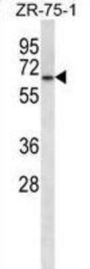 Glycerol-3-Phosphate Dehydrogenase 2 (GPD2) Antibody