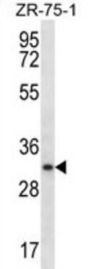 Myogenin (MYOG) Antibody
