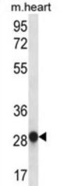 Myogenin (MYOG) Antibody