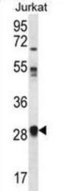 Olfactory Receptor Family 11 Subfamily L Member 1 (OR11L1) Antibody