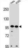 WD Repeat-Containing Protein 3 (WDR3) Antibody