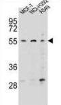 ZNF117 Antibody