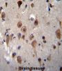 LRRC28 Antibody