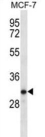 Testis Serine Protease 1 (TESSP1) Antibody