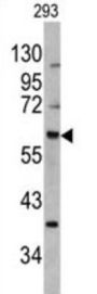 MDM2 Antibody