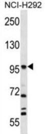 Prolyl Endopeptidase FAP (FAP) Antibody